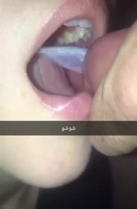 hot shosho