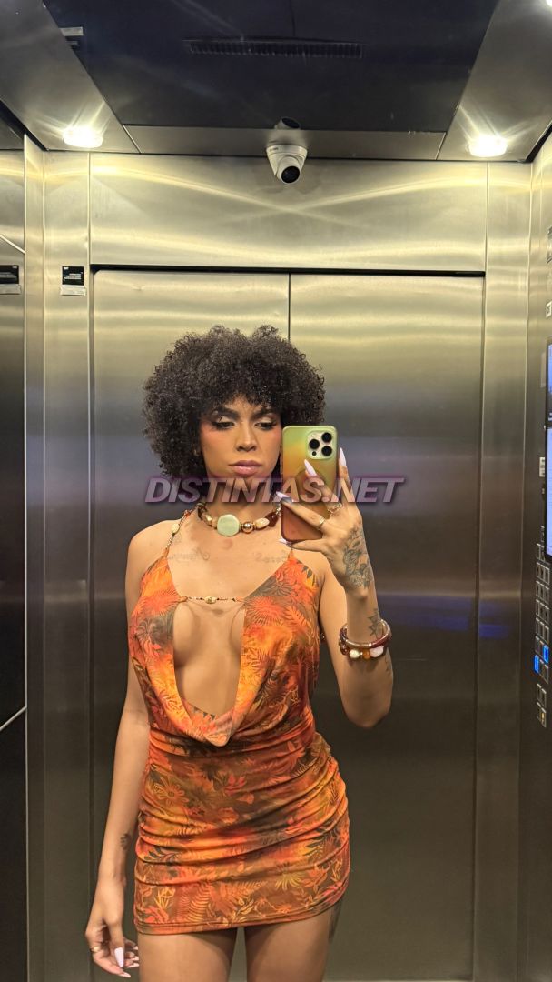 Winnie Harlow