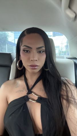 Winnie Harlow
