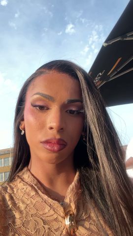 Winnie Harlow