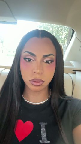Winnie Harlow