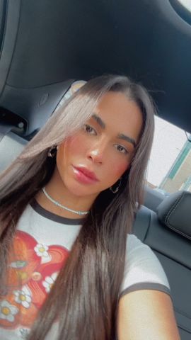 Winnie Harlow