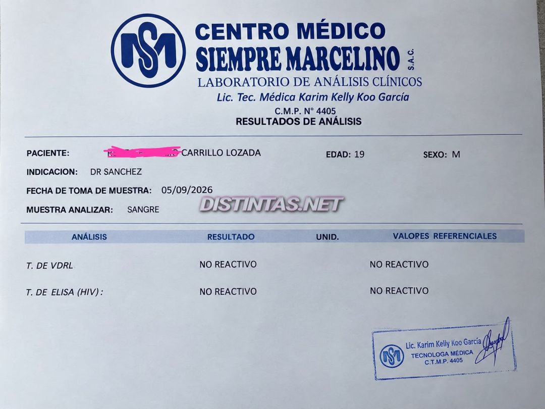 Vale Lozada 